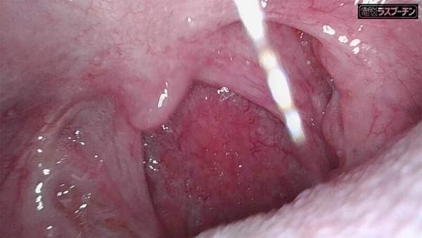 DRPT-099 이미지 #21