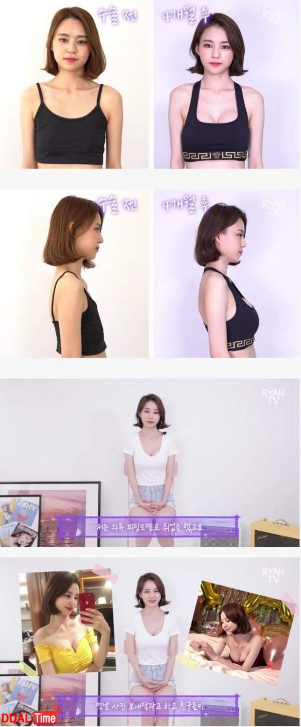 가슴 수술하고 취업까지 성공했다는 누나 이미지 #1